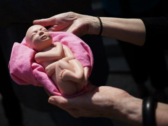 Planned Parenthood abortion